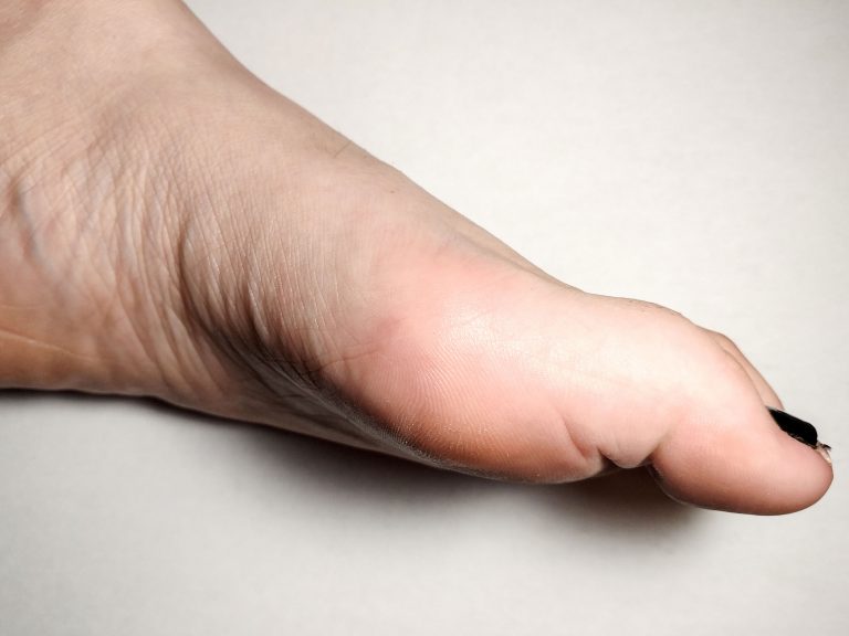 niepokojący wygląd paznokci - leczenie