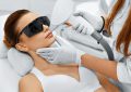 depilacja laserowa dla kobiet