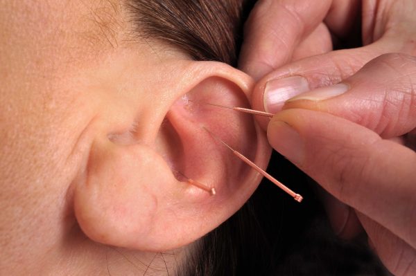 akupunktura ucha - na co pomaga