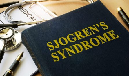 sjogren's syndrome