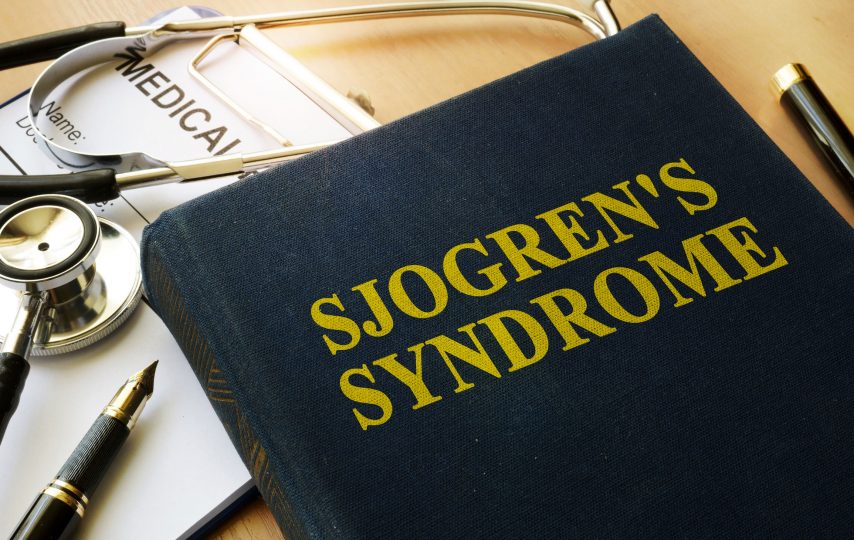 sjogren's syndrome