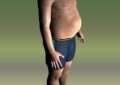 otyłość brzuszna